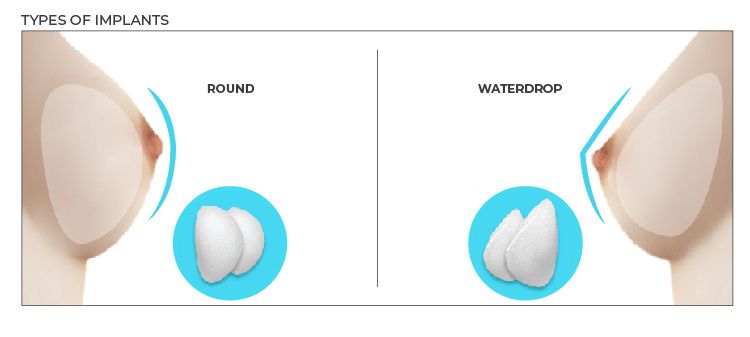 Hip Replacement Surgery Duration thumbnail