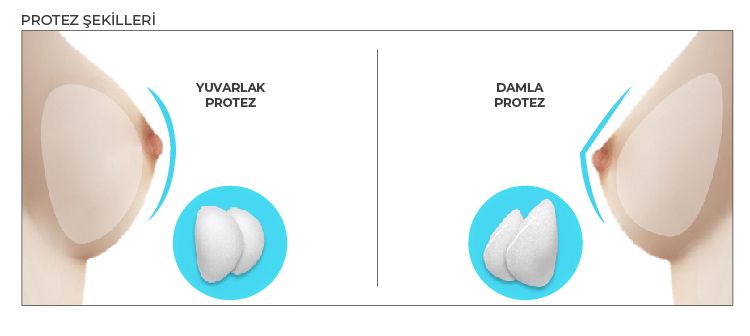 Meme protezi tipleri