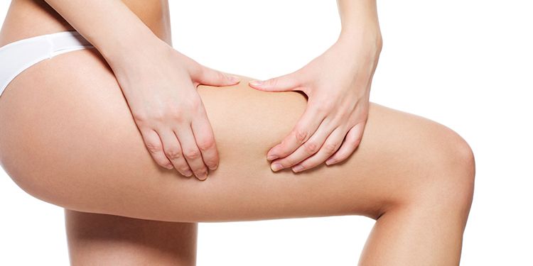 Thigh Lift Scars, What to Expect