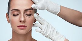 Göz kapağı estetiği